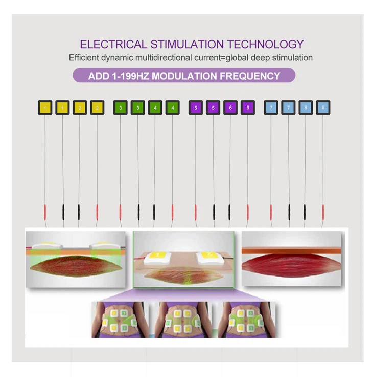 non surgical body contouring machine (2)